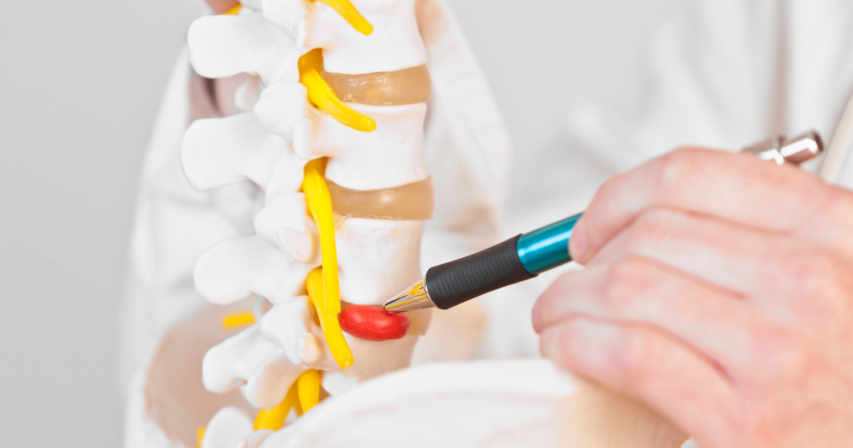 Conservative and Aggressive Treatment Options for Disc Herniations