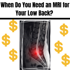 When Do You Need an MRI for Your Low Back?