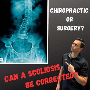 Chiropractic or Surgery…Which is Best for Correcting a Scoliosis?