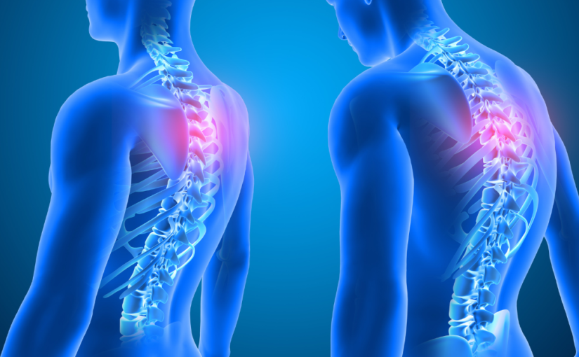 improve posture