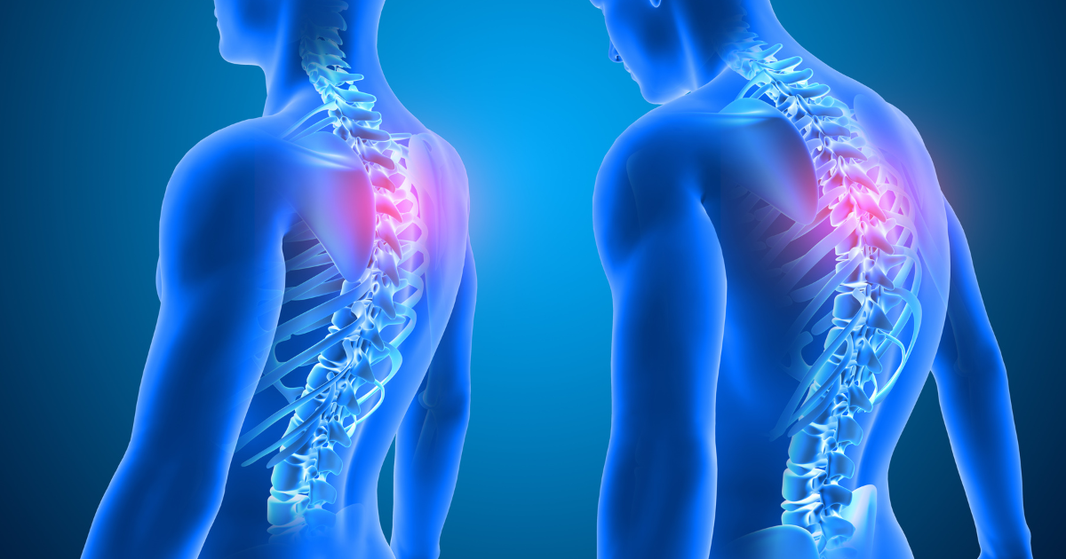 Improve Your Posture With This Guide